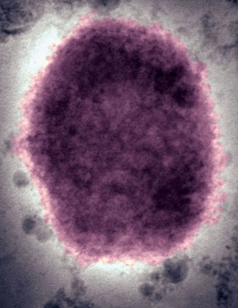 电子显微镜下的猴痘病毒.jpg