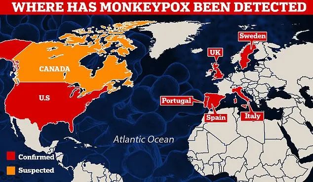 截至5月19日欧美的猴痘疫情分布图.jpg